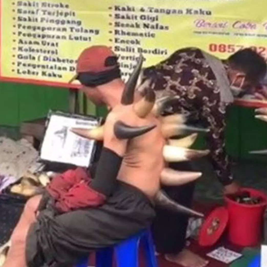 Viral teknik bekam pakai tanduk, komentar netizen kocak abis