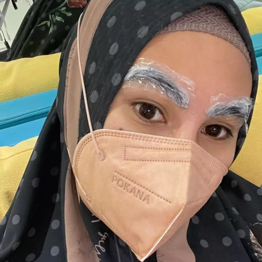 7 Potret terbaru Kartika Putri usai lakukan laser alis