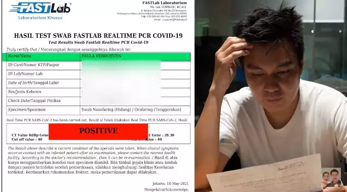 Paula Verhoeven covid dua kali © 2021 brilio.net