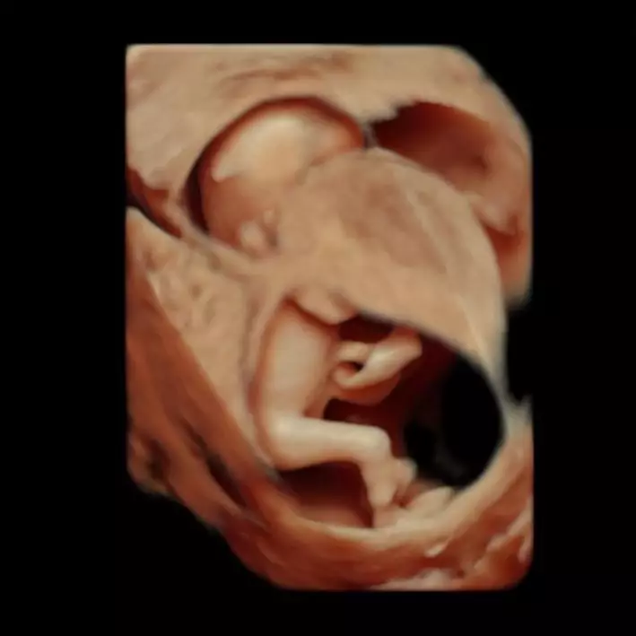 nagita slavina unggah foto usg © Instagram