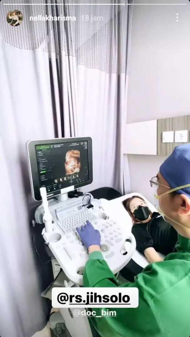 Nella Kharisma unggah foto USG © 2021 brilio.net