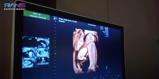 Momen Nagita Slavina cek USG 4D © YouTube