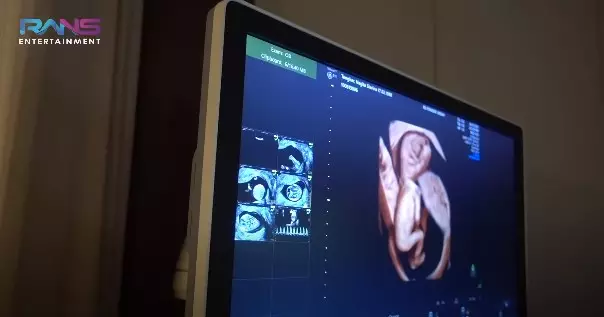 Momen Nagita Slavina cek USG 4D © YouTube