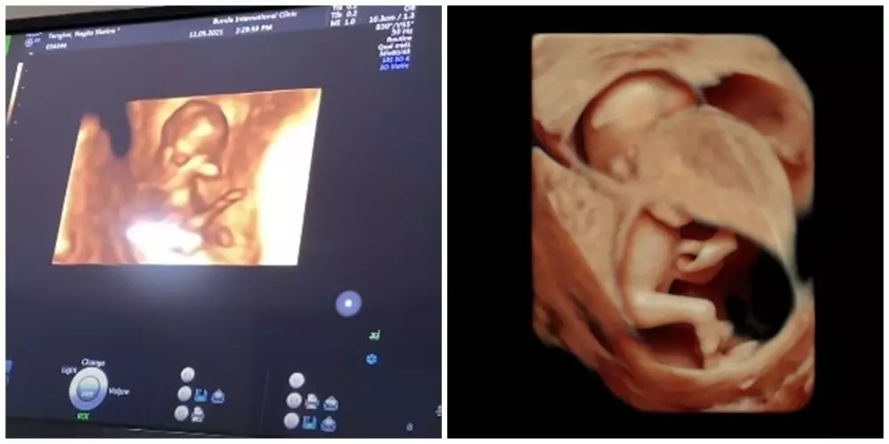 Momen Nagita Slavina cek USG 4D © YouTube