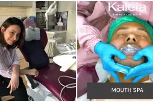 Mouth spa, treatment untuk membuat mulut lebih relaks