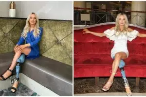 8 Potret Bernadette Hagans, model disabilitas ikuti kontes kecantikan