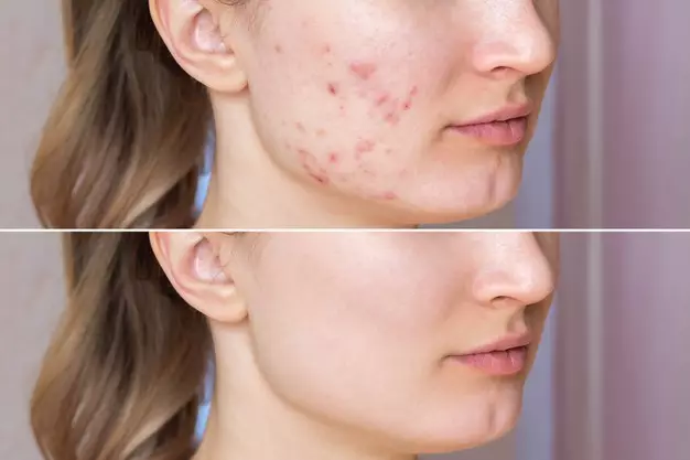 Manfaat buah plum untuk kecantikan © 2021 brilio.net