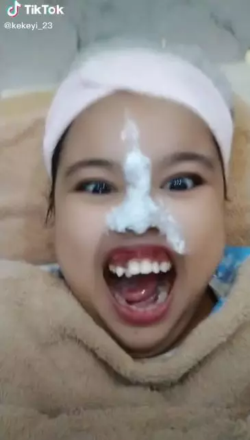 kekeyi filler hidung dipuji cantik © berbagai sumber