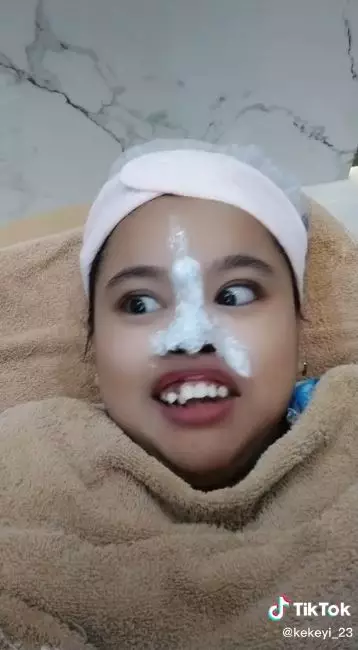 kekeyi filler hidung dipuji cantik © berbagai sumber