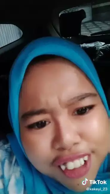 kekeyi filler hidung dipuji cantik © berbagai sumber