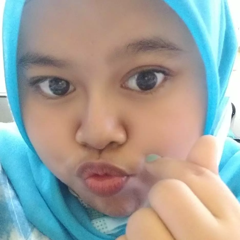 kekeyi filler hidung dipuji cantik © berbagai sumber