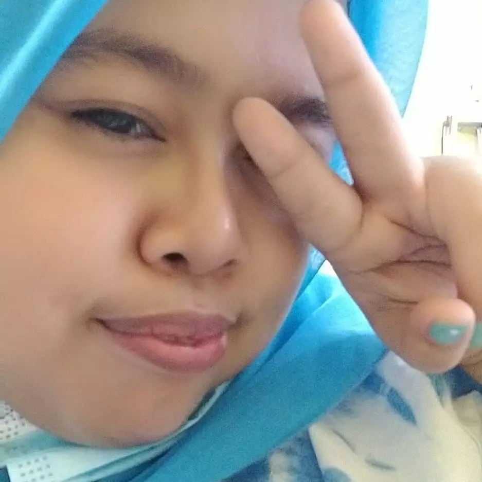 kekeyi filler hidung dipuji cantik © berbagai sumber