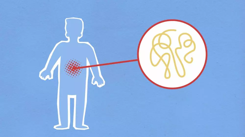 Manfaat kubis turunkan kadar kolesterol © 2021 brilio.net