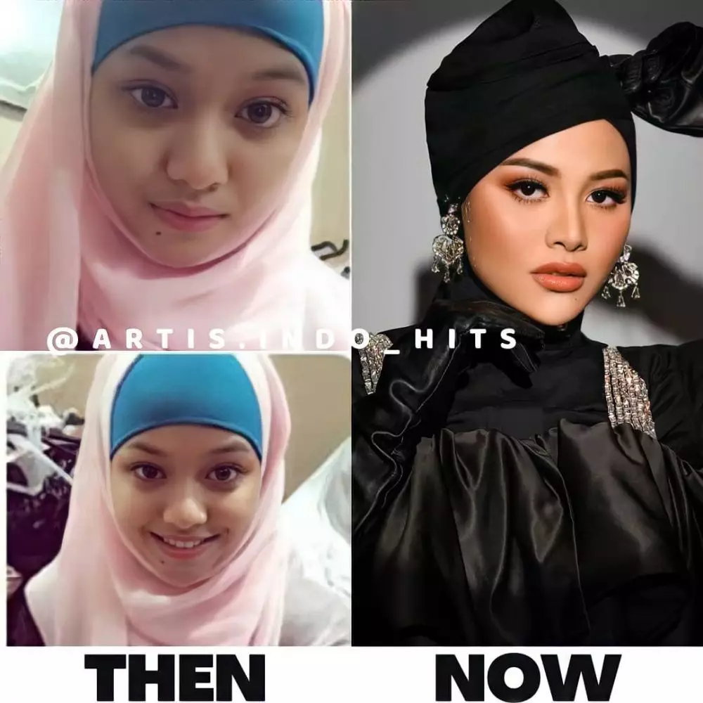 potret lawas remaja Aurel © 2021 brilio.net