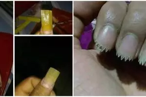 10 Penampakan nyeleneh kuku usai perawatan ini kocak abis