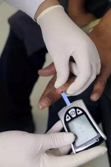 Manfaat asam jawa untuk kesehatan © 2021 brilio.net