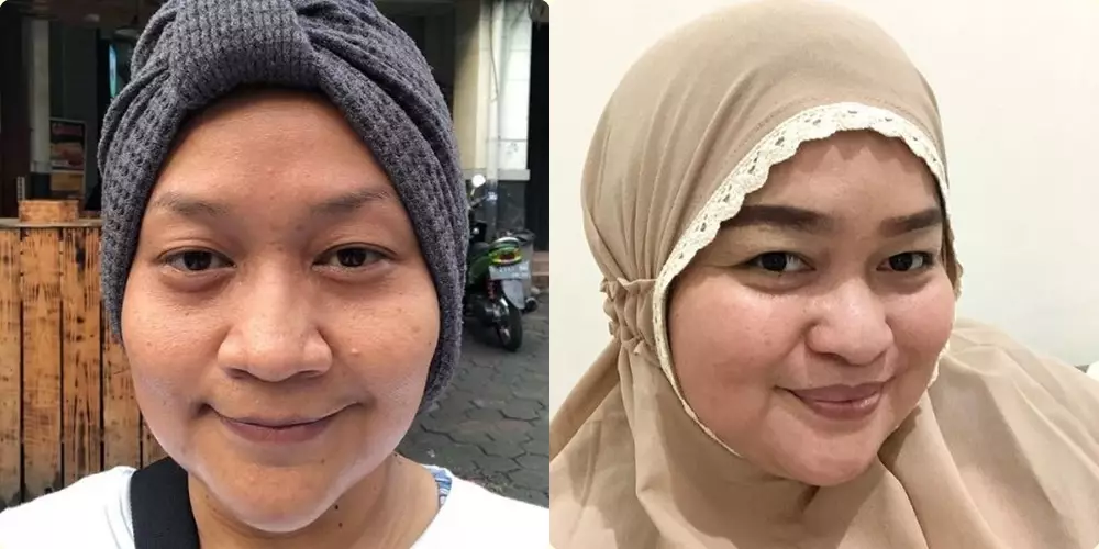 bukti Sinyo dan Tike kembar © Instagram