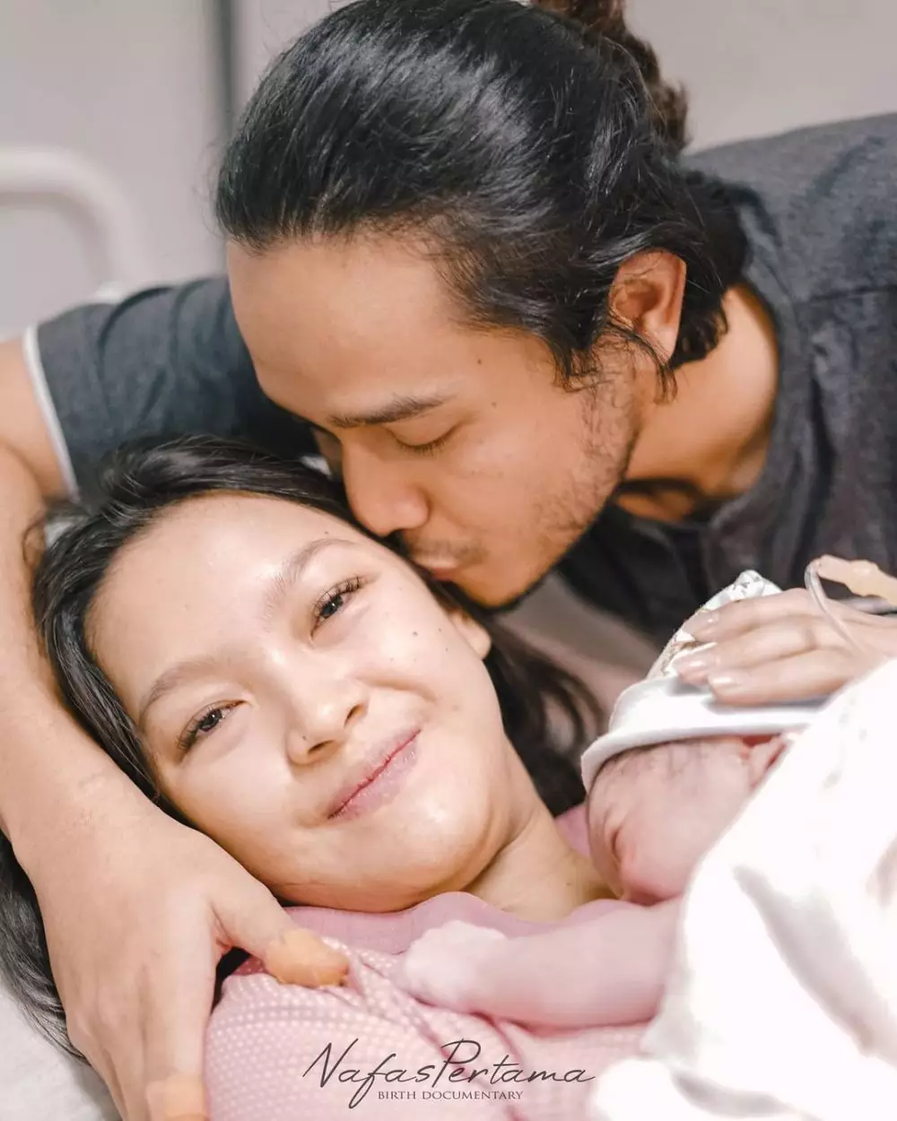 ana riana alami sakit dbd © instagram