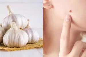 19 Manfaat bawang putih untuk kesehatan dan kecantikan