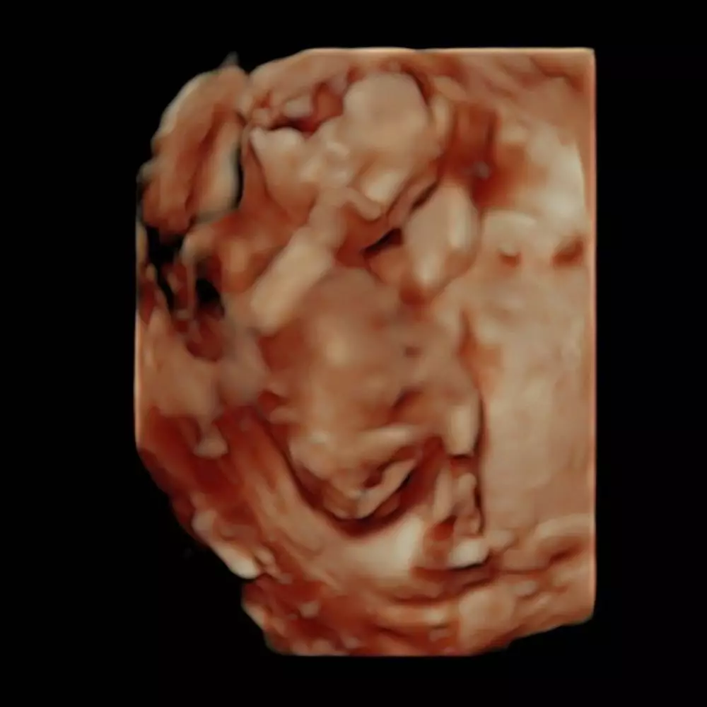 Felicya Angelista unggah foto USG  © 2021 brilio.net Instagram