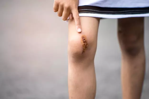 Manfaat getah pepaya © berbagai sumber