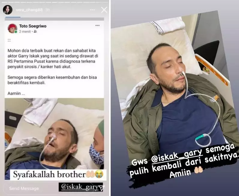 kondisi terkini Gary Iskak © 2021 brilio.net