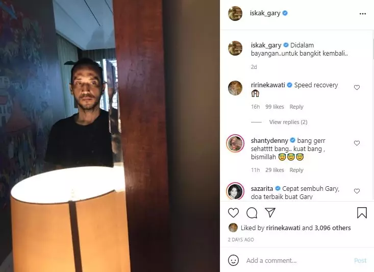 kondisi terkini Gary Iskak © 2021 brilio.net