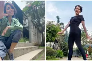 Demi senyum menawan, Tya Ariestya rela potong gusi