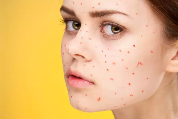 Manfaat kunyit untuk kecantikan © 2021 brilio.net