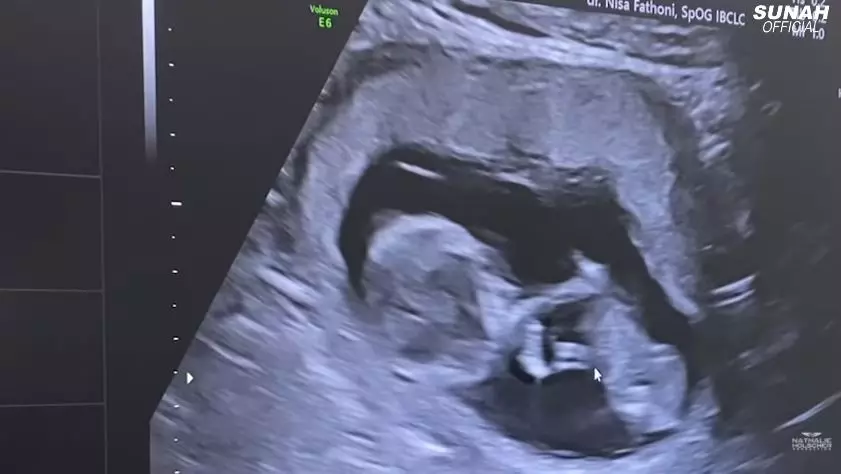 momen nathalie cek kandungan ungkap jenis kelamin © YouTube