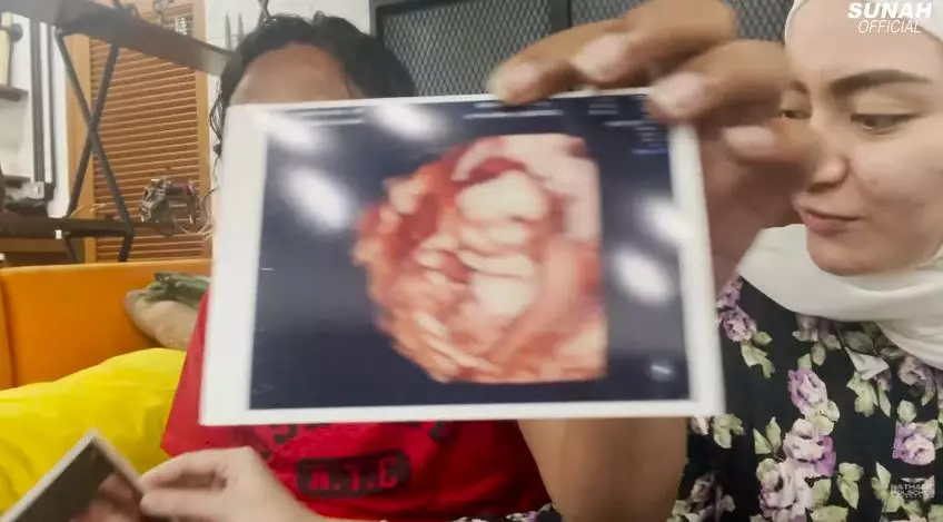 momen nathalie cek kandungan ungkap jenis kelamin © YouTube