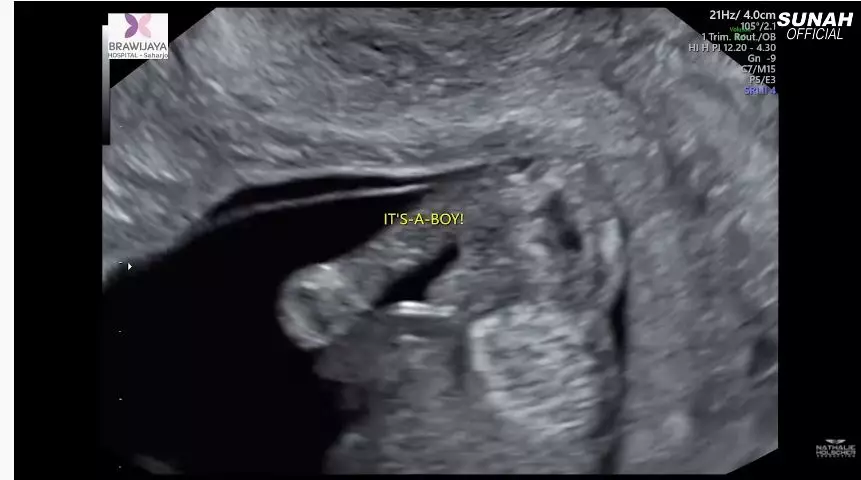 momen nathalie cek kandungan ungkap jenis kelamin © YouTube