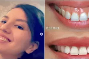 8 Potret terbaru Tya Ariestya usai operasi potong gusi, menawan