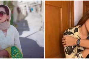 Perjuangan 8 seleb hadapi autoimun, Ashanty berobat ke Turki