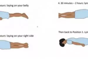 6 Fakta proning, teknik membantu pasien Covid-19 lebih mudah bernapas