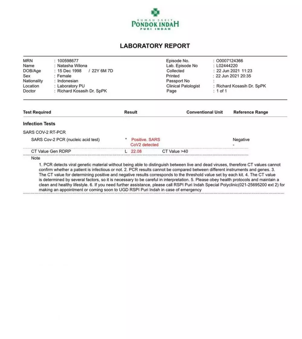 Natasha Wilona usai dituding positif Covid-19 © 2021 brilio.net