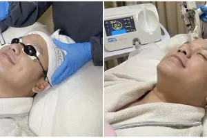 3 Perawatan unggulan di B Clinic X Tities Sapoetra, glowing & kinclong