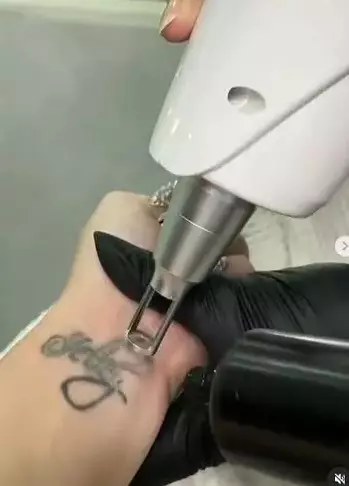 Momen Celine Evangelista hapus semua tato © Instagram/@celine_evangelista