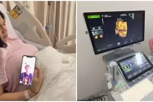 10 Momen Felicya Angelista dilarikan ke RS, ungkap kondisi janin