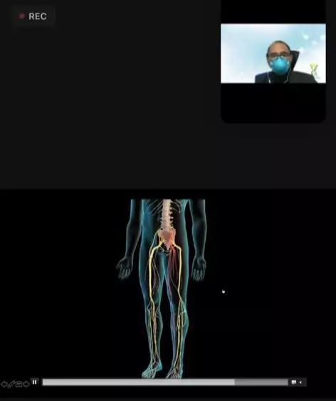 Saraf terjepit © 2021 brilio.net