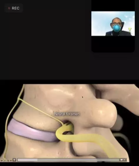 Saraf terjepit © 2021 brilio.net