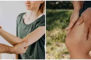 16 Penyebab rematik, kenali gejala, penyebab, dan cara mencegahnya