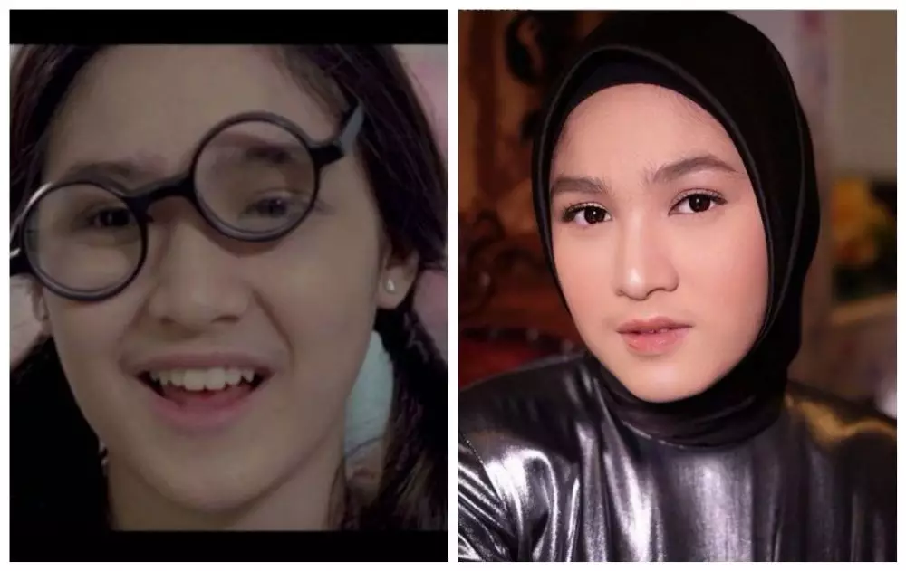 seleb perankan sosok culun  © berbagai sumber seleb perankan sosok culun  © berbagai sumber