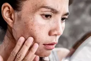 Disepelekan, 5 kesalahan pakai sunscreen ini malah bikin wajah kusam