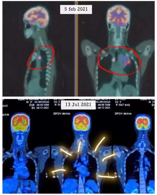 suami tasya sembuh dari kanker Instagram/@tasyakamila