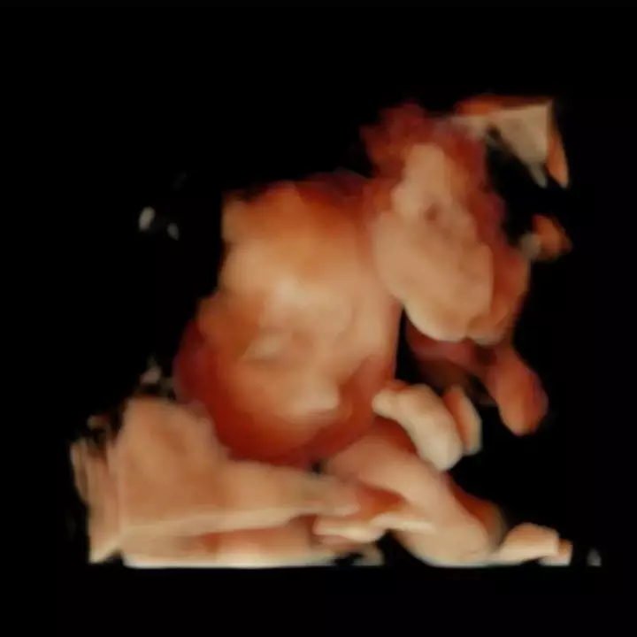 Nagita Slavina sebut calon buah hatinya mancung Instagram