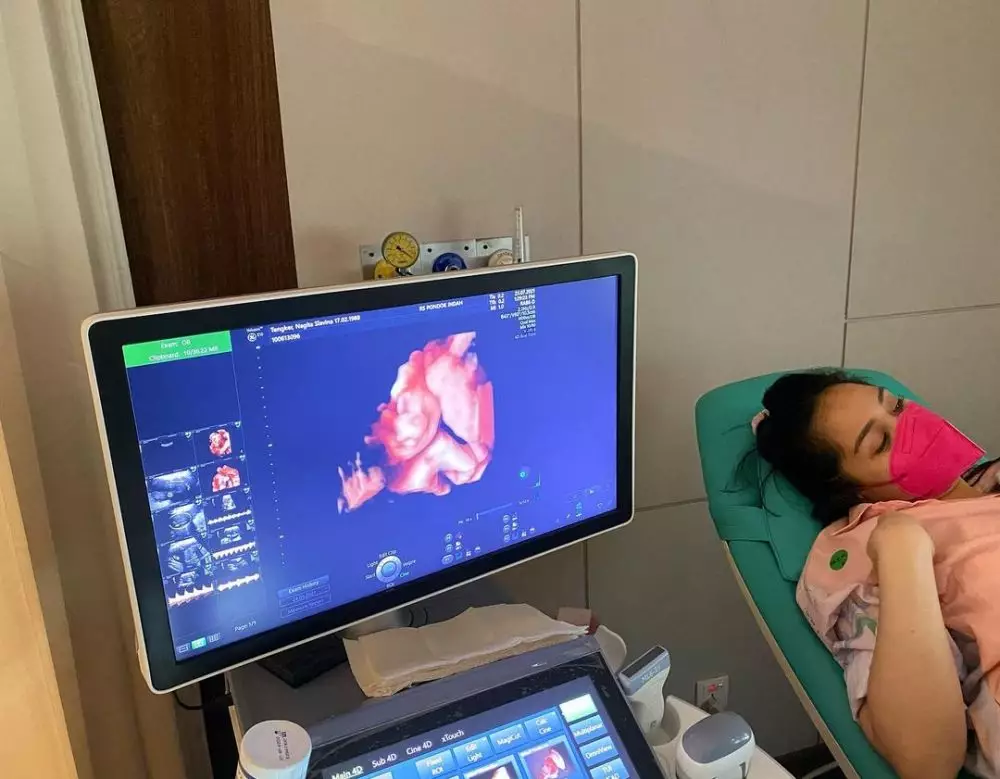 Nagita Slavina sebut calon buah hatinya mancung Instagram