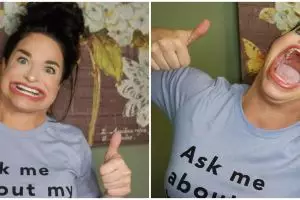 Samantha Ramsdell, wanita dengan rekor mulut terbesar di dunia