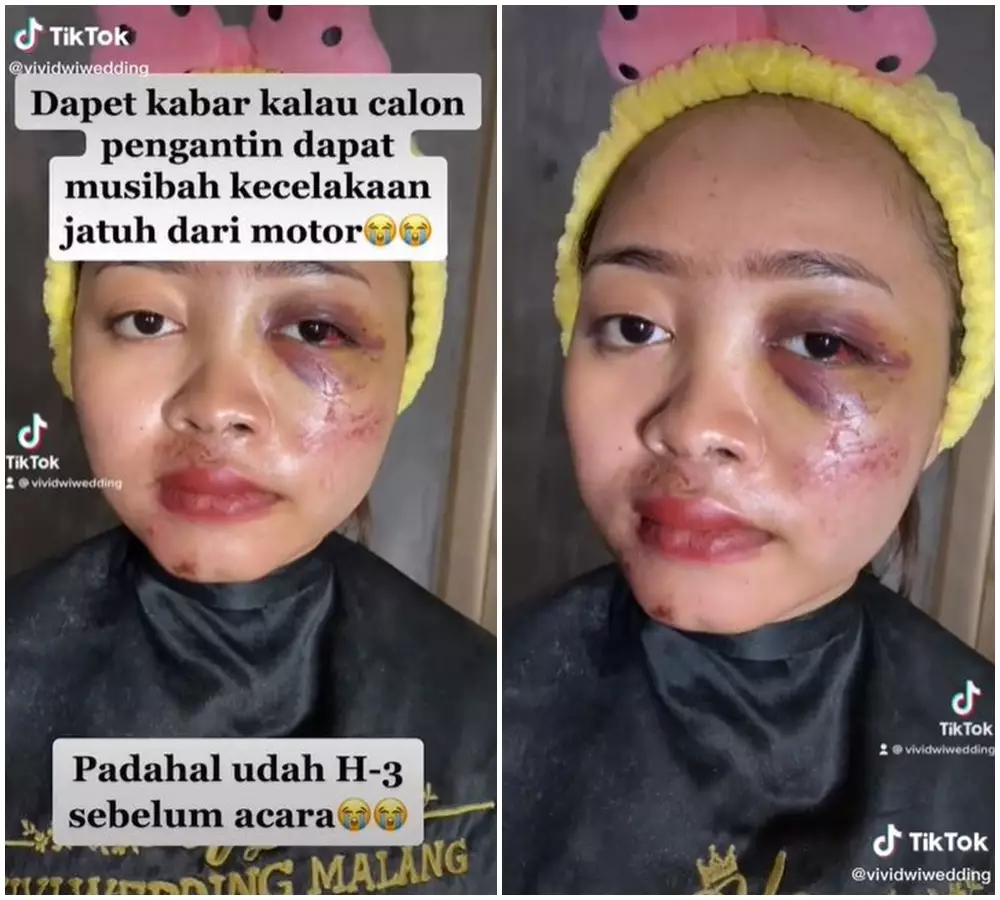 pengantin kecelakaan h-3 pernikahan © 2021 TikTok