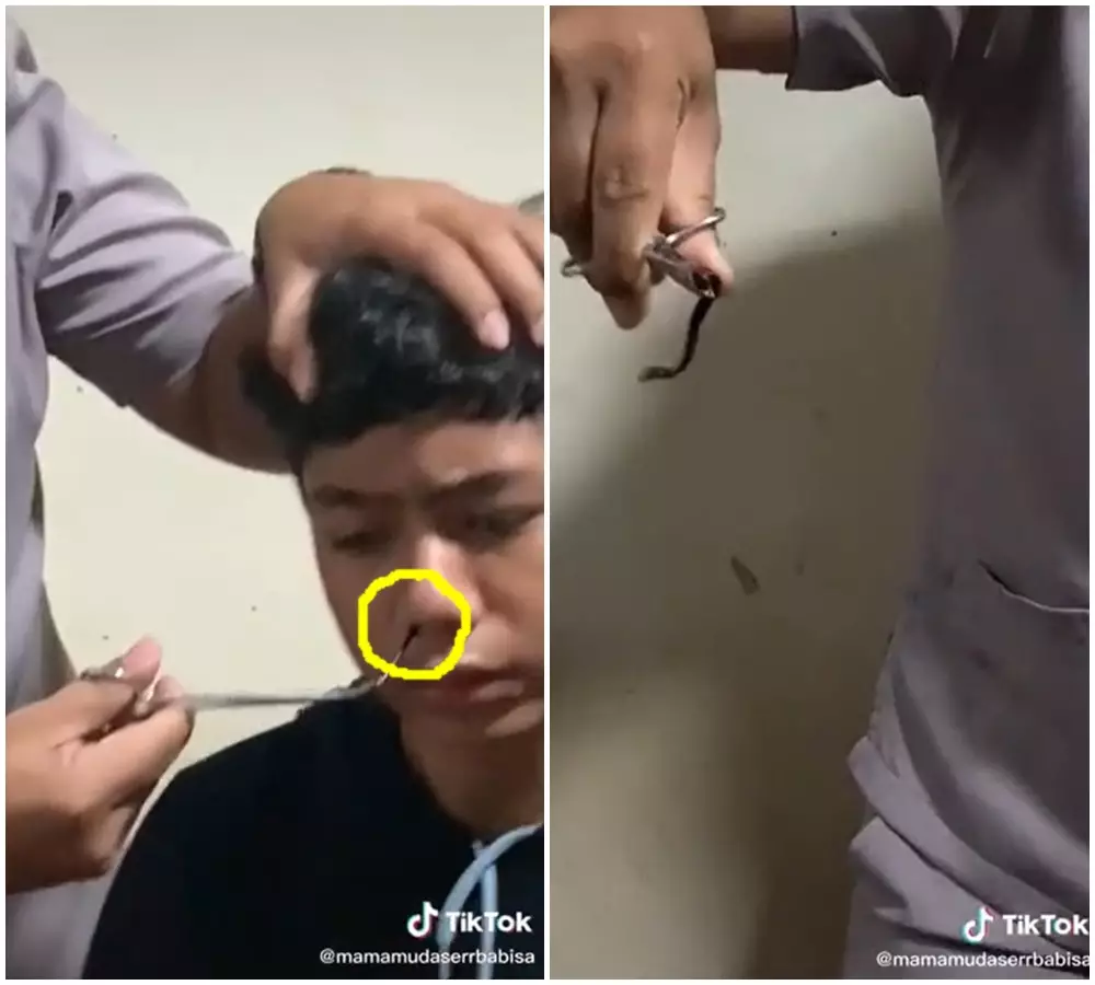 viral lintah masuk hidung © 2021 TikTok viral lintah masuk hidung © 2021 TikTok